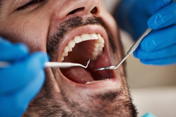 Best Broken or Cracked Tooth Emergency Dentist in Creedmoor, NC