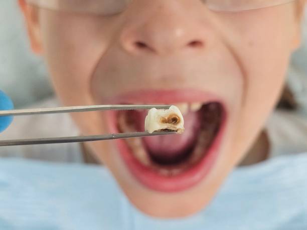 Best Pediatric Emergency Dentist in Creedmoor, NC